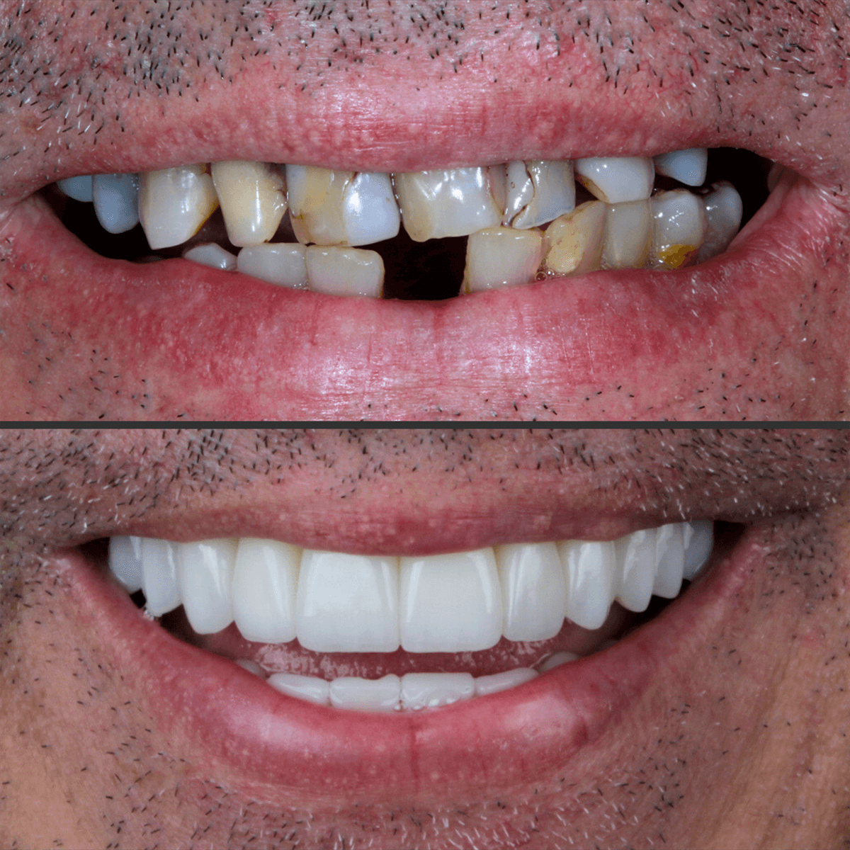 Tratamento Completo / Reabilitação Oral